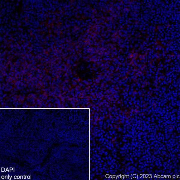 Immunohistochemistry (Frozen sections) - Alexa Fluor® 555 Anti-CD4 antibody [EPR19514] (AB313727), expandable thumbnail