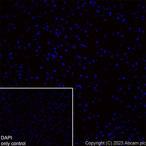 Immunohistochemistry (Frozen sections) - Alexa Fluor® 555 Anti-CD4 antibody [EPR19514] (AB313727), expandable thumbnail