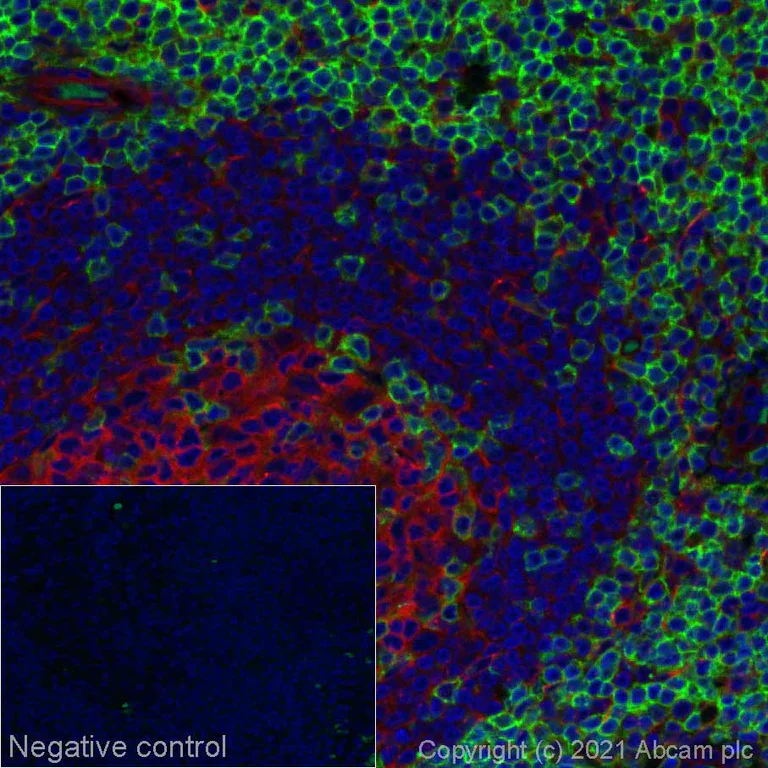 Immunohistochemistry (Formalin/PFA-fixed paraffin-embedded sections) - Alexa Fluor® 555 Anti-CD4 antibody [EPR6855] (AB280849)