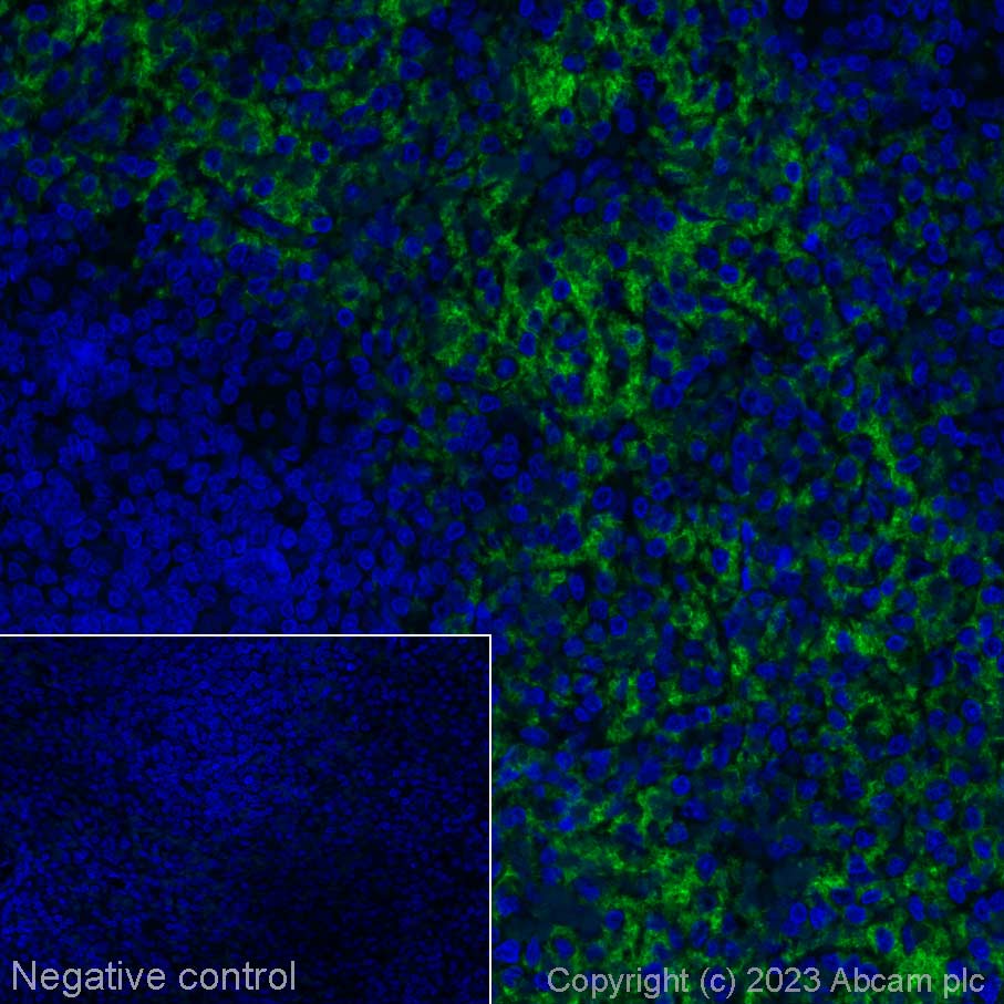 Immunohistochemistry (Formalin/PFA-fixed paraffin-embedded sections) - Alexa Fluor® 555 Anti-CD42b antibody [SP219] (AB314255), expandable thumbnail