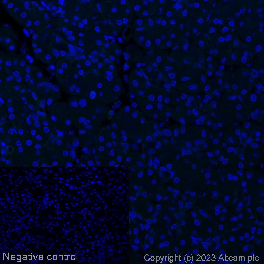Immunohistochemistry (Formalin/PFA-fixed paraffin-embedded sections) - Alexa Fluor® 555 Anti-CD42b antibody [SP219] (AB314255), expandable thumbnail