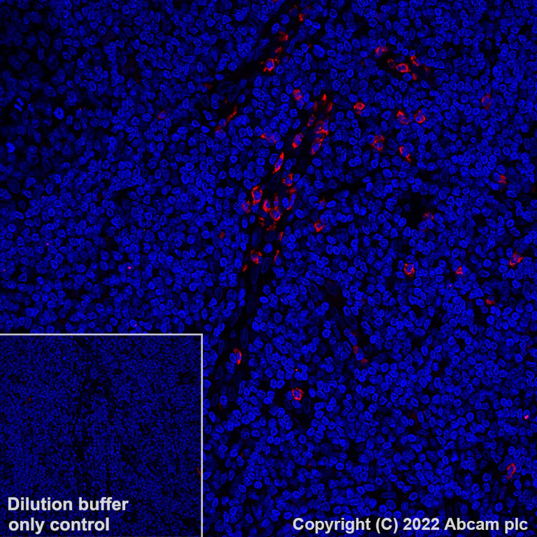 Immunohistochemistry (Formalin/PFA-fixed paraffin-embedded sections) - Alexa Fluor® 555 Anti-CD66b antibody [EPR25354-2] (AB307627)
