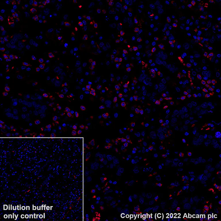 Immunohistochemistry (Formalin/PFA-fixed paraffin-embedded sections) - Alexa Fluor® 555 Anti-CD66b antibody [EPR25354-2] (AB307627)