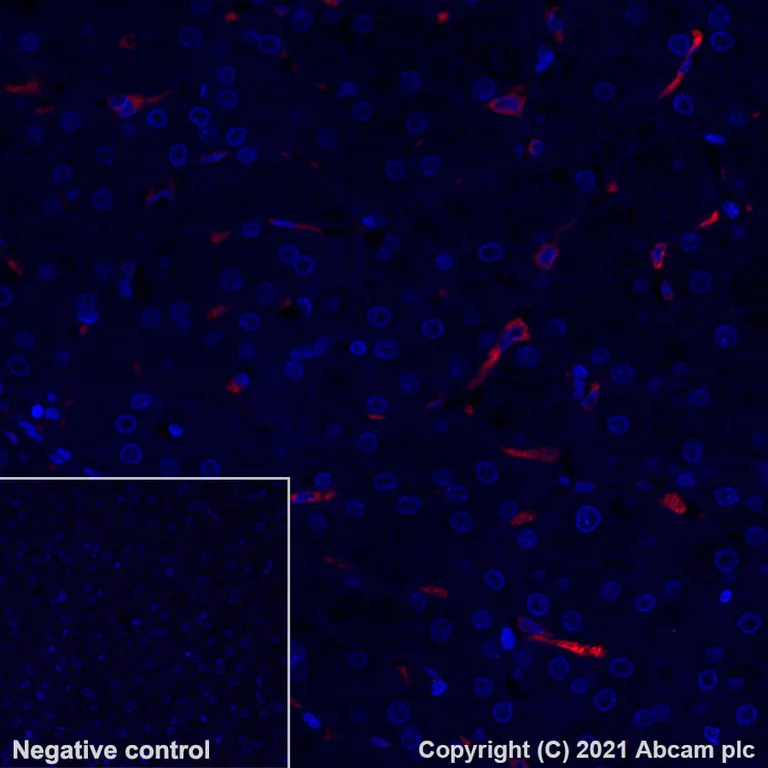 Immunohistochemistry (Formalin/PFA-fixed paraffin-embedded sections) - Alexa Fluor® 555 Anti-CD68 antibody [KP1] (AB279323)