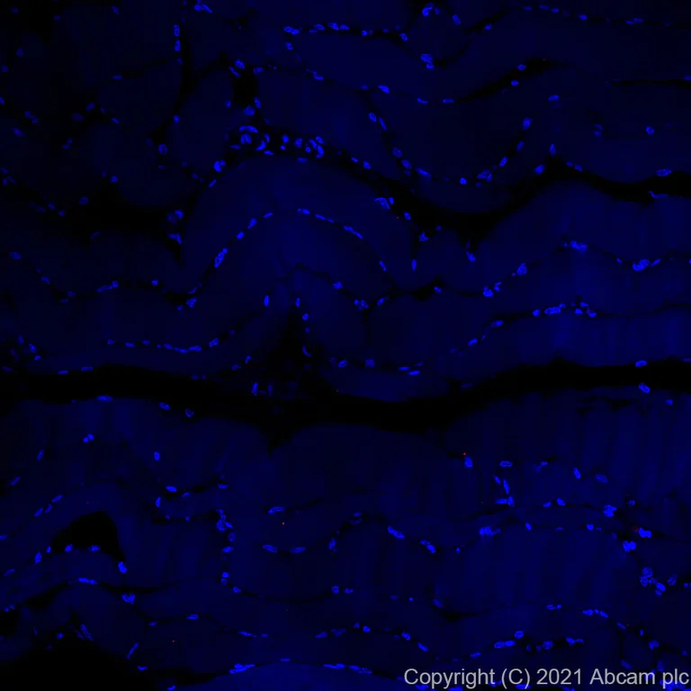 Immunohistochemistry (Formalin/PFA-fixed paraffin-embedded sections) - Alexa Fluor® 555 Anti-CD68 antibody [KP1] (AB279323)