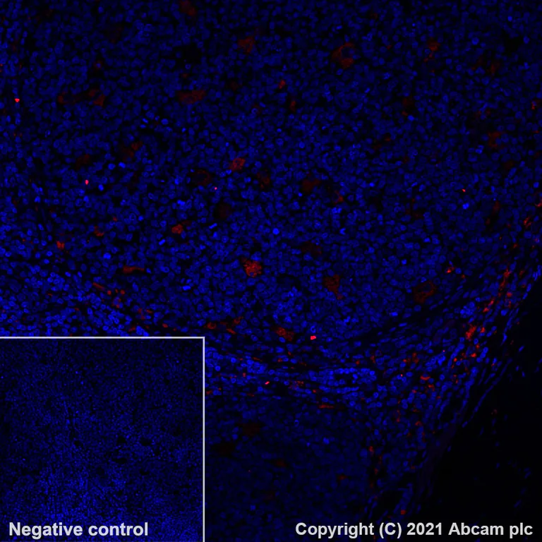 Anti-CD68 Alexa Fluor® 555 antibody [KP1] (ab279323) IgG1 | Abcam