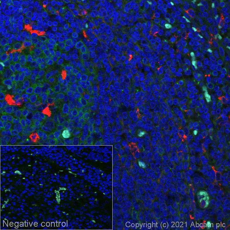 Anti-CD68 Alexa Fluor® 555 antibody [KP1] (ab279323) IgG1 | Abcam