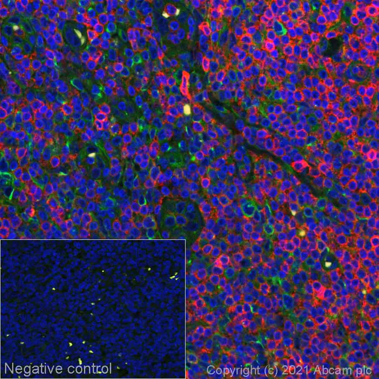 Immunohistochemistry (Formalin/PFA-fixed paraffin-embedded sections) - Alexa Fluor® 555 Anti-CD7 antibody [EPR4242] (AB279334)
