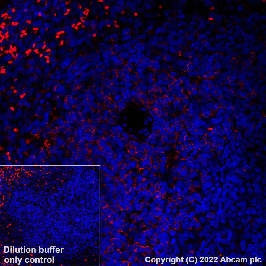 Immunohistochemistry (Formalin/PFA-fixed paraffin-embedded sections) - Alexa Fluor® 555 Anti-CD8 alpha antibody [CAL66] (AB305367), expandable thumbnail