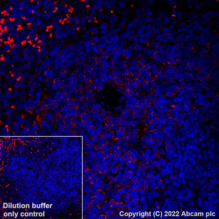 Immunohistochemistry (Formalin/PFA-fixed paraffin-embedded sections) - Alexa Fluor® 555 Anti-CD8 alpha antibody [CAL66] (AB305367)