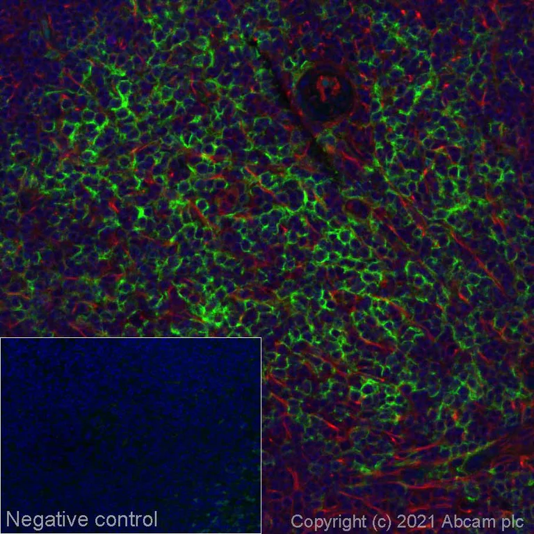 Immunohistochemistry (Formalin/PFA-fixed paraffin-embedded sections) - Alexa Fluor® 555 Anti-CD8 alpha antibody [EPR21769] (AB280863)
