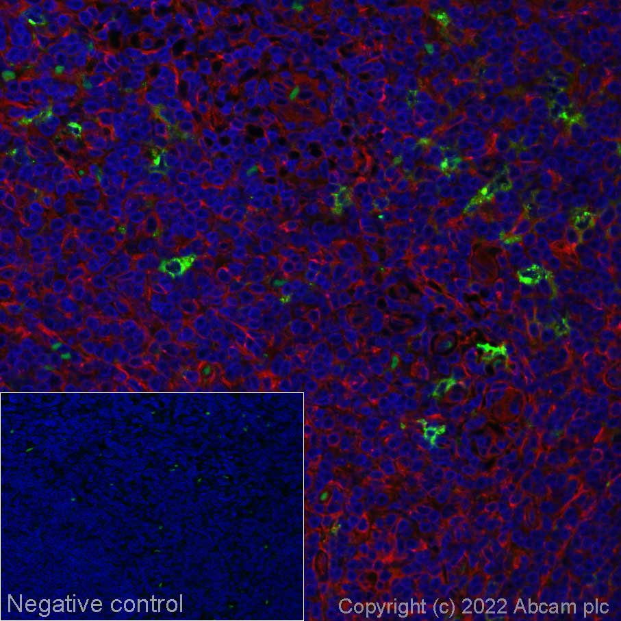 Immunohistochemistry (Formalin/PFA-fixed paraffin-embedded sections) - Alexa Fluor® 555 Anti-CD83 antibody [EPR23809-19] (AB283493)