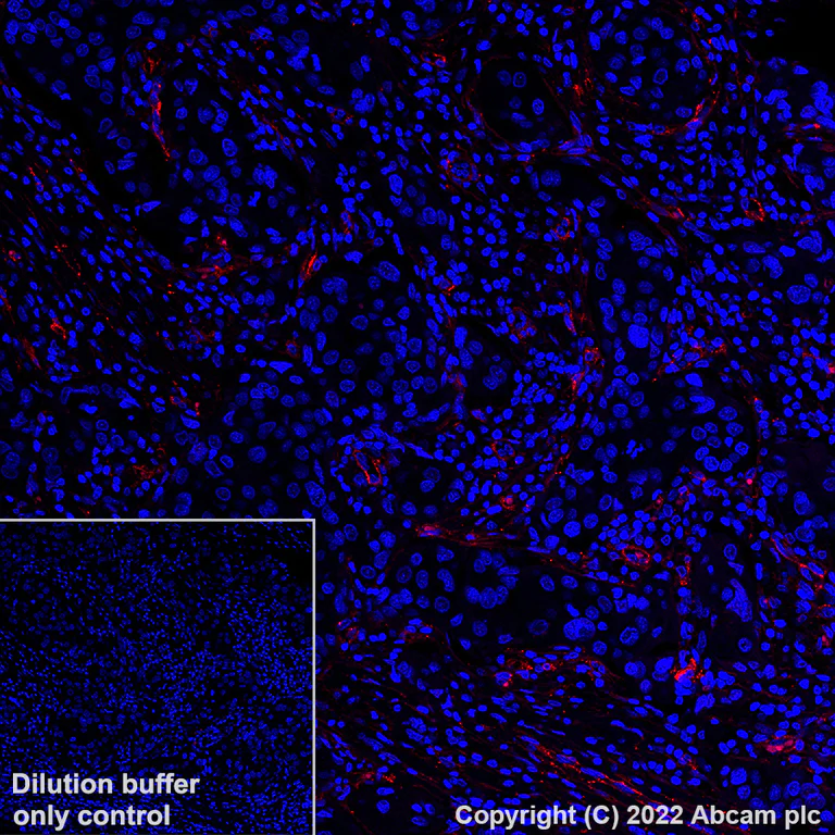 Immunohistochemistry (Formalin/PFA-fixed paraffin-embedded sections) - Alexa Fluor® 555 Anti-CD90 / Thy1 antibody [EPR3132] (AB307267)