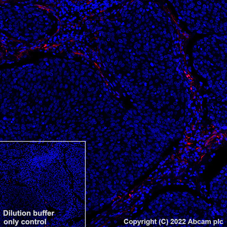 Immunohistochemistry (Formalin/PFA-fixed paraffin-embedded sections) - Alexa Fluor® 555 Anti-CD90 / Thy1 antibody [EPR3132] (AB307267)