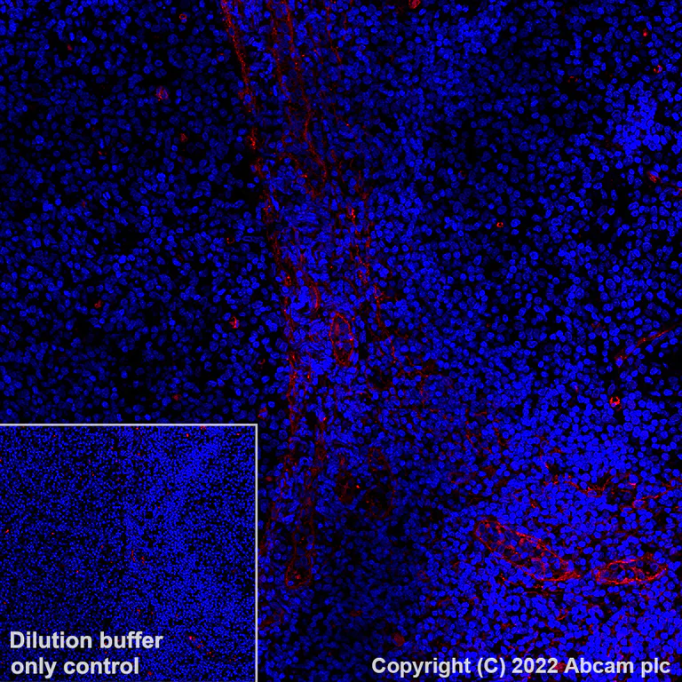 Immunohistochemistry (Formalin/PFA-fixed paraffin-embedded sections) - Alexa Fluor® 555 Anti-CD90 / Thy1 antibody [EPR3132] (AB307267)