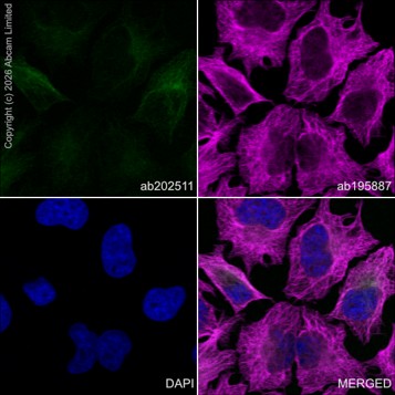Immunocytochemistry/ Immunofluorescence - Alexa Fluor® 555 Anti-CD90 / Thy1 antibody [EPR3133] (AB202511)