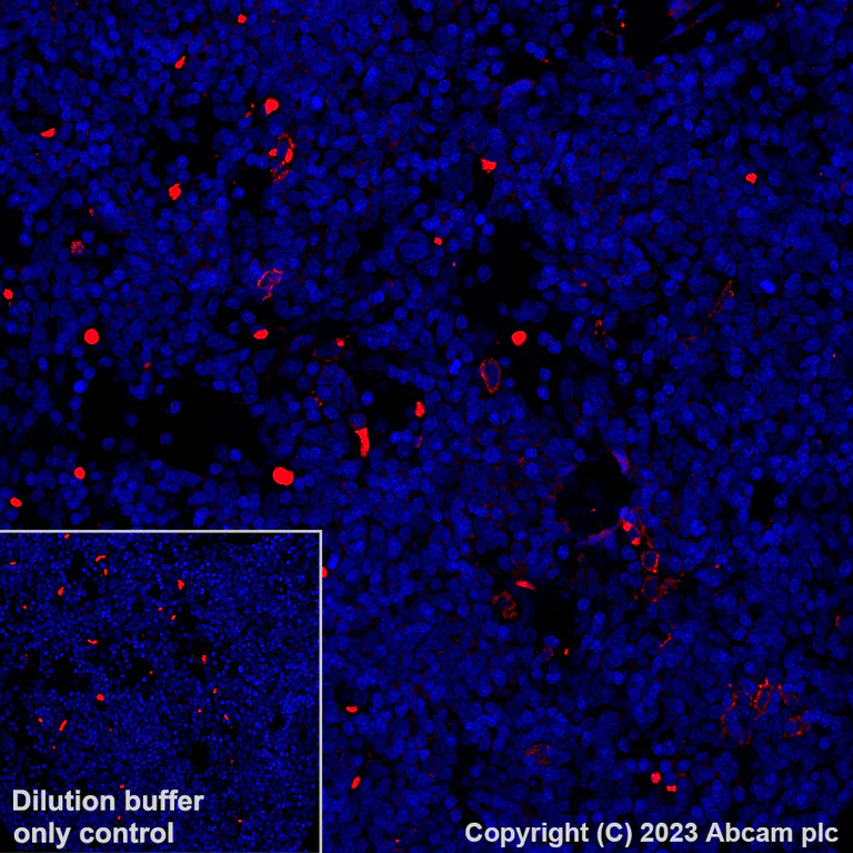 Immunohistochemistry (Formalin/PFA-fixed paraffin-embedded sections) - Alexa Fluor® 555 Anti-CLEC9A antibody [EPR22324] (AB313594)