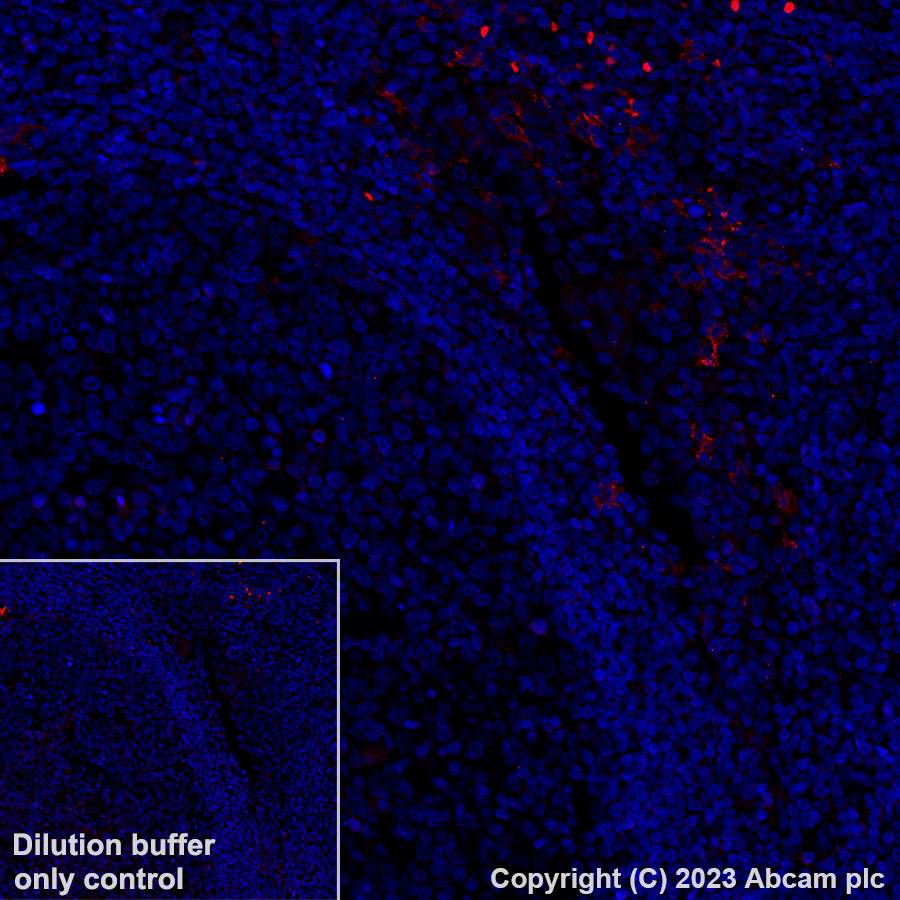 Immunohistochemistry (Formalin/PFA-fixed paraffin-embedded sections) - Alexa Fluor® 555 Anti-CLEC9A antibody [EPR22324] (AB313594)