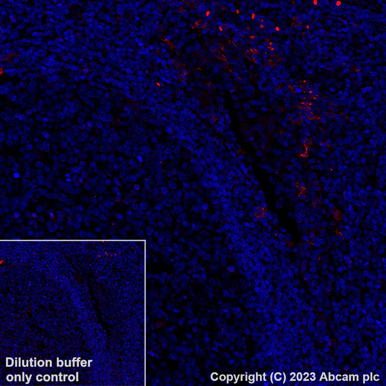 Immunohistochemistry (Formalin/PFA-fixed paraffin-embedded sections) - Alexa Fluor® 555 Anti-CLEC9A antibody [EPR22324] (AB313594)