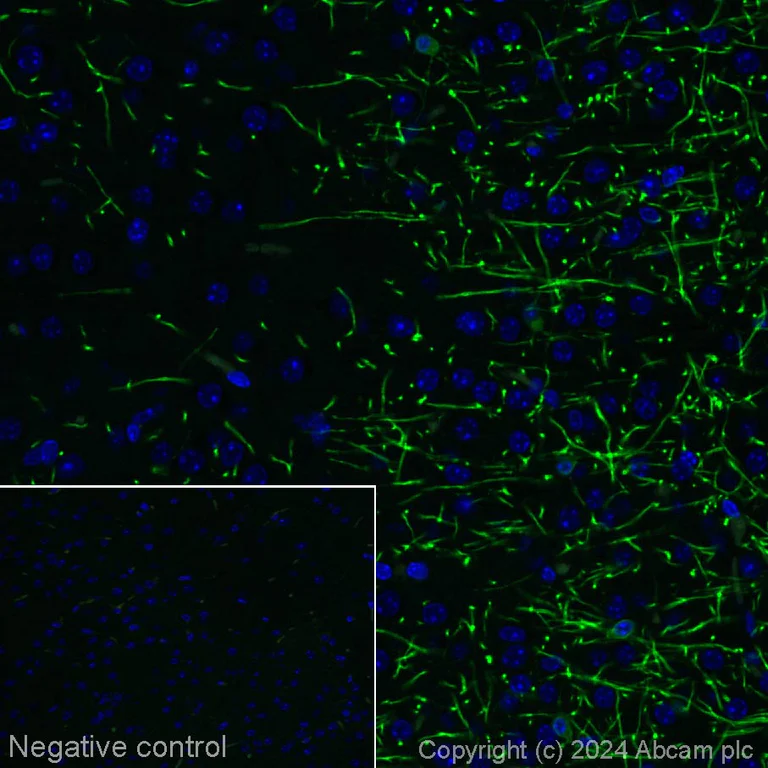 Immunohistochemistry (Formalin/PFA-fixed paraffin-embedded sections) - Alexa Fluor® 555 Anti-CNPase antibody [11-5B] (AB317592)