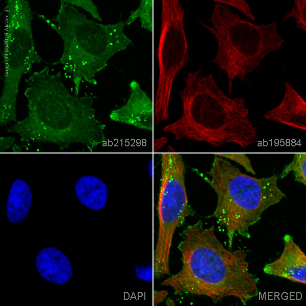 Immunocytochemistry/ Immunofluorescence - Alexa Fluor® 555 Anti-Cortactin antibody [EP1922Y] (AB215298), expandable thumbnail