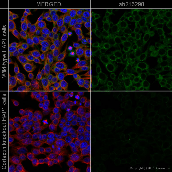 Immunocytochemistry/ Immunofluorescence - Alexa Fluor® 555 Anti-Cortactin antibody [EP1922Y] (AB215298), expandable thumbnail