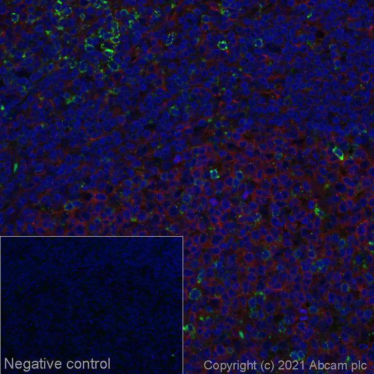 Immunohistochemistry (Formalin/PFA-fixed paraffin-embedded sections) - Alexa Fluor® 555 Anti-CTLA4 antibody [CAL49] (AB283489)