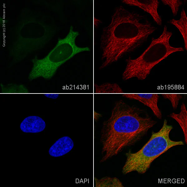 Immunocytochemistry/ Immunofluorescence - Alexa Fluor® 555 Anti-Cyclin B1 antibody [Y106] (AB214381)