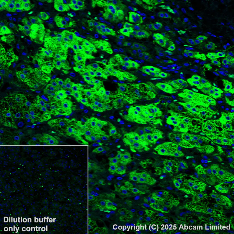 Immunohistochemistry (Formalin/PFA-fixed paraffin-embedded sections) - Alexa Fluor® 555 Anti-CYP21A2 antibody [EPR29787-27] (AB325704)
