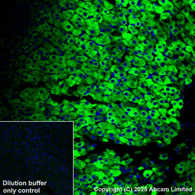 Immunohistochemistry (Formalin/PFA-fixed paraffin-embedded sections) - Alexa Fluor® 555 Anti-CYP21A2 antibody [EPR29787-27] (AB325704)