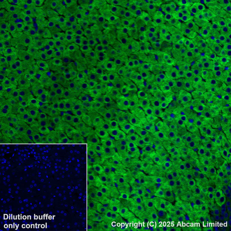 Immunohistochemistry (Formalin/PFA-fixed paraffin-embedded sections) - Alexa Fluor® 555 Anti-CYP21A2 antibody [EPR29787-27] (AB325704)