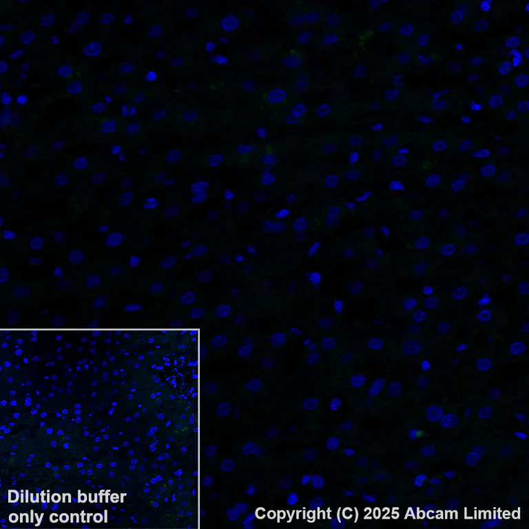 Immunohistochemistry (Formalin/PFA-fixed paraffin-embedded sections) - Alexa Fluor® 555 Anti-CYP21A2 antibody [EPR29787-27] (AB325704)