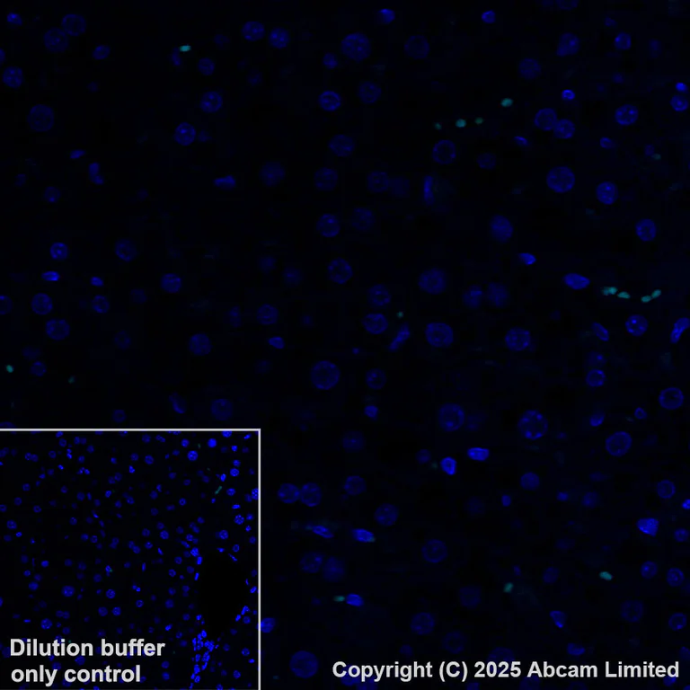 Immunohistochemistry (Formalin/PFA-fixed paraffin-embedded sections) - Alexa Fluor® 555 Anti-CYP21A2 antibody [EPR29787-27] (AB325704)