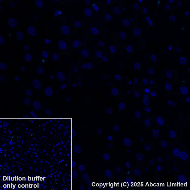 Immunohistochemistry (Formalin/PFA-fixed paraffin-embedded sections) - Alexa Fluor® 555 Anti-CYP21A2 antibody [EPR29787-27] (AB325704)