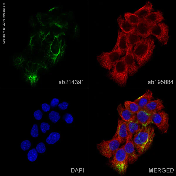 Immunocytochemistry/ Immunofluorescence - Alexa Fluor® 555 Anti-Cytokeratin 14 antibody [EP1612Y] (AB214391)