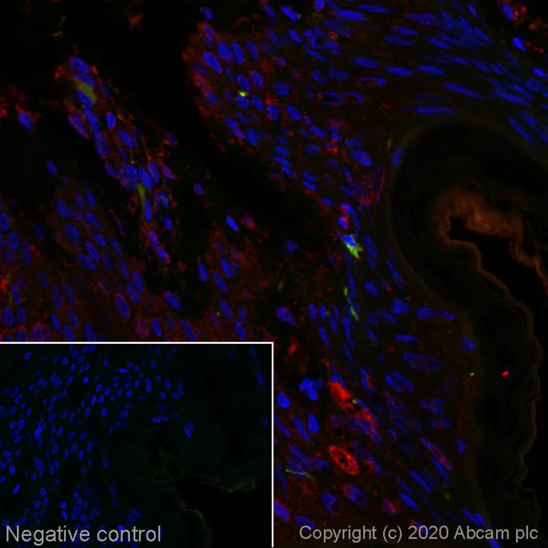 Immunohistochemistry (Formalin/PFA-fixed paraffin-embedded sections) - Alexa Fluor® 555 Anti-Cytokeratin 14 antibody [EP1612Y] (AB214391)