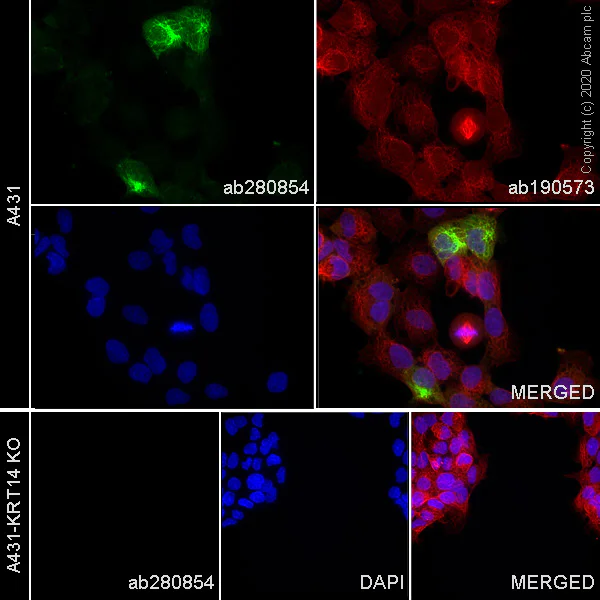 Immunocytochemistry - Alexa Fluor® 555 Anti-Cytokeratin 14 antibody [EPR17350] (AB280854)