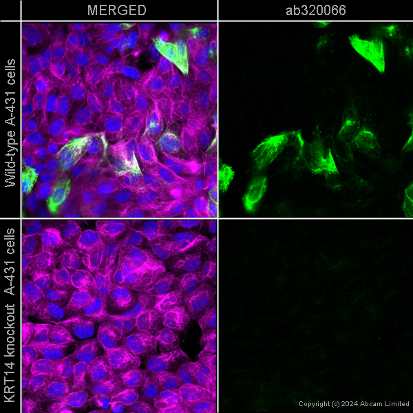 Immunocytochemistry/ Immunofluorescence - Alexa Fluor® 555 Anti-Cytokeratin 14 antibody [LL002] (AB320066), expandable thumbnail
