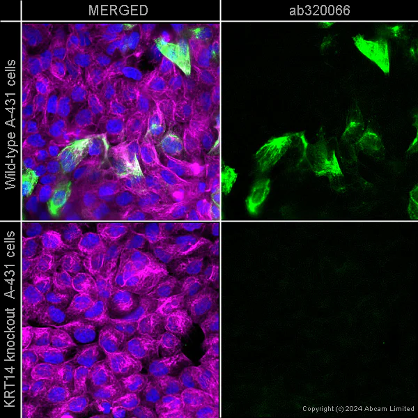 Alexa Fluor® 555 Anti-Cytokeratin 14 antibody [LL002] KO Tested