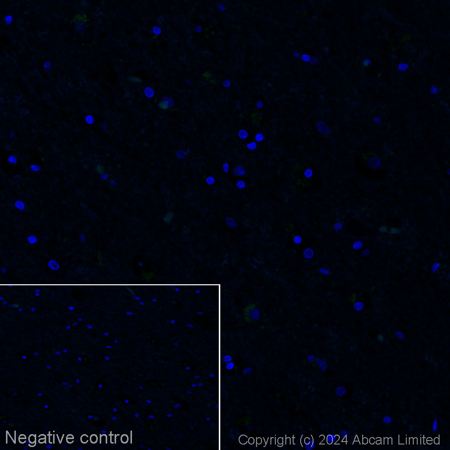 Immunohistochemistry (Formalin/PFA-fixed paraffin-embedded sections) - Alexa Fluor® 555 Anti-Cytokeratin 14 antibody [LL002] (AB320066), expandable thumbnail
