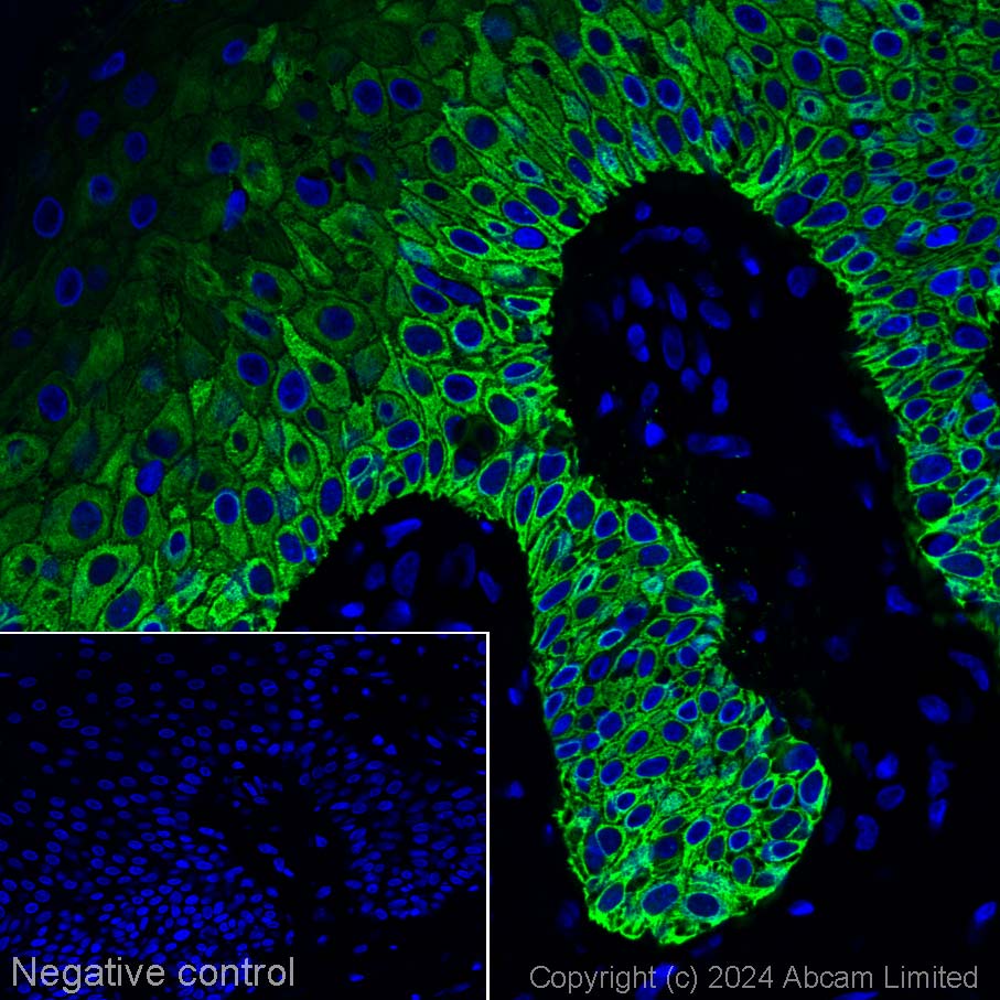 Immunohistochemistry (Formalin/PFA-fixed paraffin-embedded sections) - Alexa Fluor® 555 Anti-Cytokeratin 14 antibody [LL002] (AB320066), expandable thumbnail