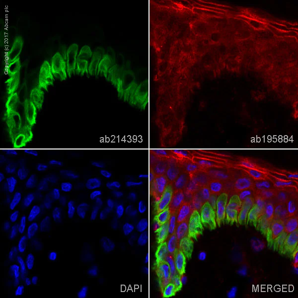 Immunohistochemistry (Frozen sections) - Alexa Fluor® 555 Anti-Cytokeratin 15 antibody [EPR1614Y] (AB214393)