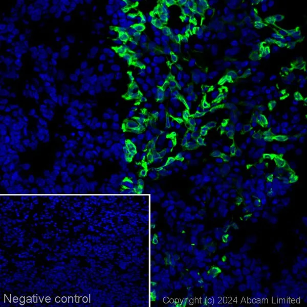 Immunohistochemistry (Frozen sections) - Alexa Fluor® 555 Anti-Cytokeratin 15 antibody [EPR1614Y] (AB214393)