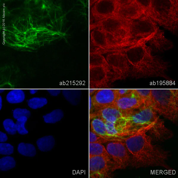 Immunocytochemistry/ Immunofluorescence - Alexa Fluor® 555 Anti-Cytokeratin 16/K16 antibody [EP1615Y] (AB215292)