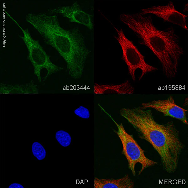 Alexa Fluor® 555 conjugated Anti-Cytokeratin 19 antibody [EP1580Y
