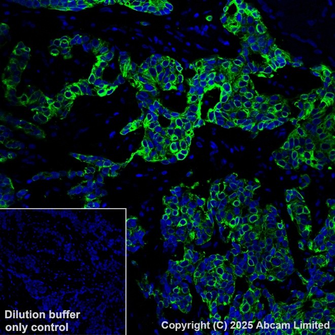 Immunohistochemistry (Formalin/PFA-fixed paraffin-embedded sections) - Alexa Fluor® 555 Anti-Cytokeratin 19 antibody [EP1580Y] (AB203444)