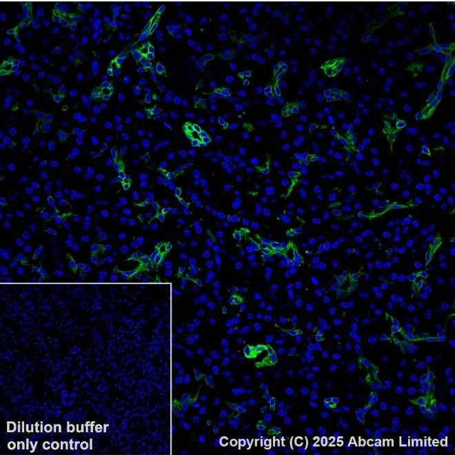 Alexa Fluor® 555 conjugated Anti-Cytokeratin 19 antibody [EP1580Y