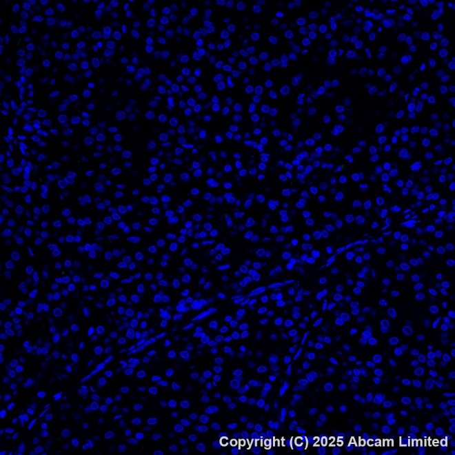 Alexa Fluor® 555 conjugated Anti-Cytokeratin 19 antibody [EP1580Y