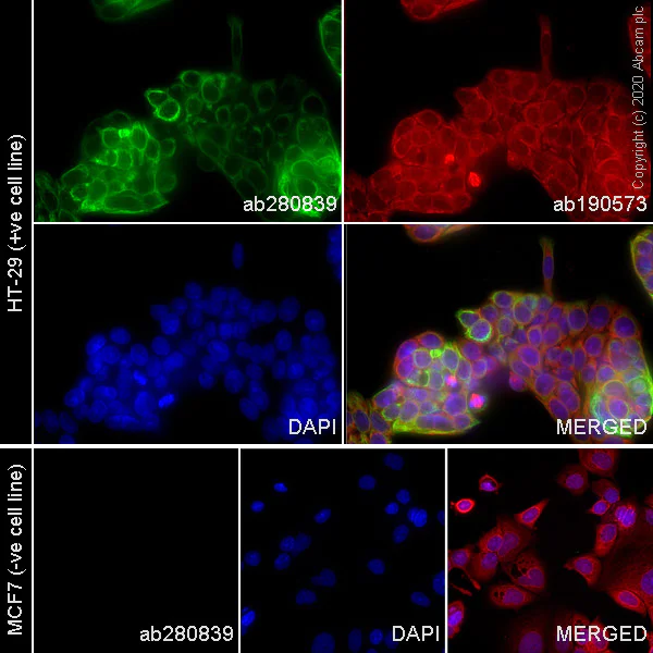 Immunocytochemistry - Alexa Fluor® 555 Anti-Cytokeratin 20 antibody [EPR1622Y] (AB280839)