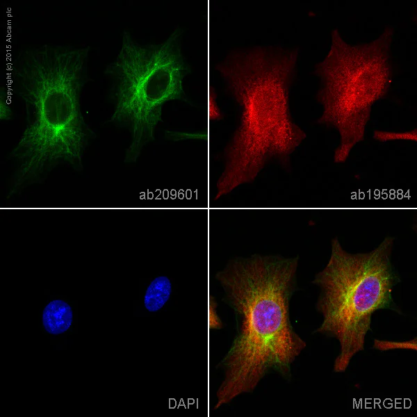 Immunocytochemistry/ Immunofluorescence - Alexa Fluor® 555 Anti-Cytokeratin 7 antibody [EPR17078] (AB209601)